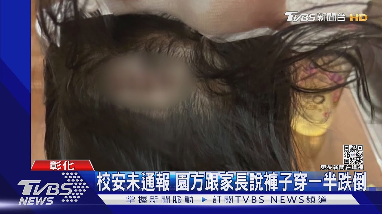 3歲女童撞破後腦勺 幼園:個性急像媽一樣