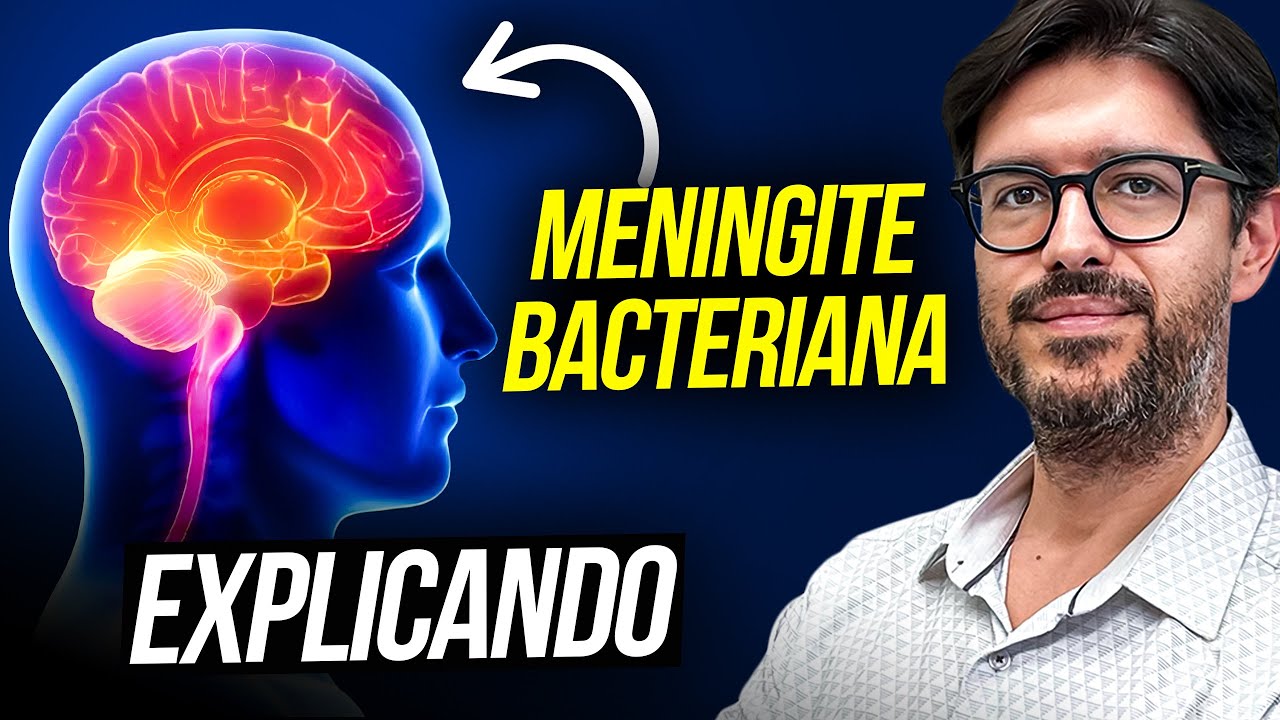 Meningite Bacteriana - O Que é Meningite Bacteriana