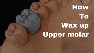 Wax up (Upper first molar)