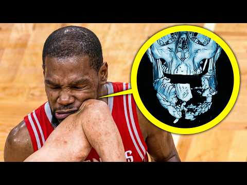 Most BRUTAL Fouls in NBA History..
