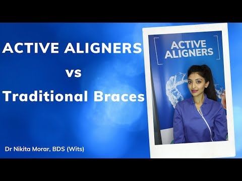 Clear Aligners vs Braces - How Do They Differ? | A Dentist's Perspective | Active Aligners