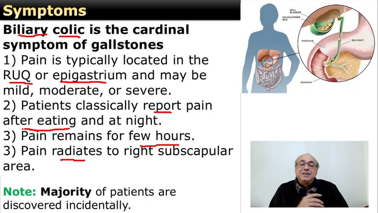 Gallbladder Stones