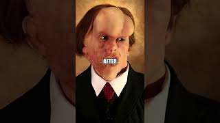 Joseph Merrick: The Heartbreaking Story of the Elephant Man