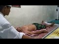 Bali Pijat Struk Tradisional Nolong Seorang Dari Abian Kapas Dps Bali