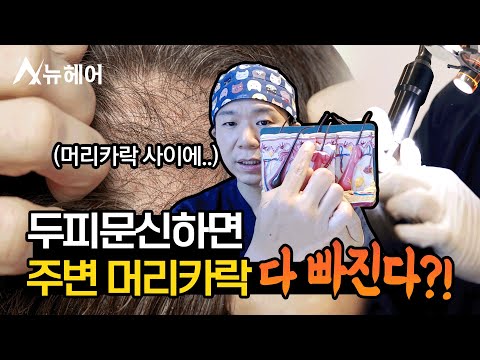 두피문신하면 주변 머리카락이 손상된다?ㅣ뉴헤어