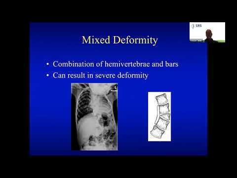 Pediatric Congenital Deformity - San Diego Fellows April 26, 2021