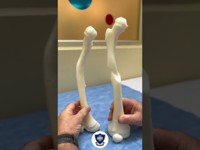 Vídeo relacionado con Manual de Impresión 3D en Cirugía Ortopédica y Traumatología: 4a Edición