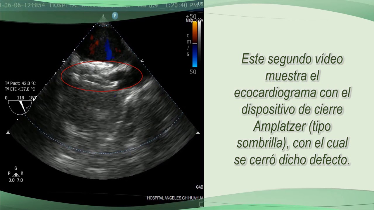 Carlos Alberto Aguirre Molina-18