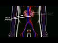 The Risks of Gadolinium (Contrast Dye)