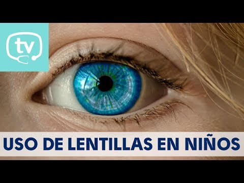 Lentillas en los niños, ¿pueden usarlas?