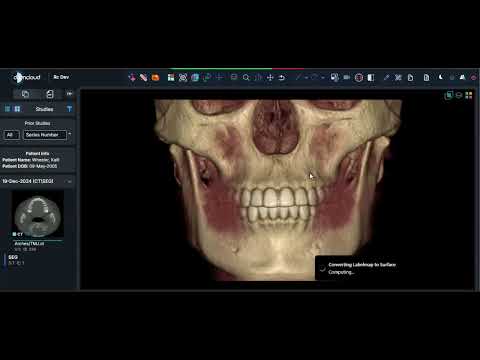 CBCT Dental Segmentation with AI | DCMCloud Viewer