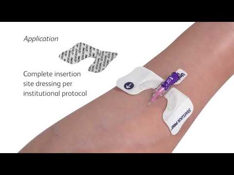 StatLock™ Pro IV Stabilization Device   Application and Removal