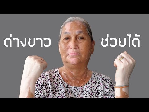 เกสรจากโรคสะเก็ดเงิน Armavir ครีมโรคสะเก็ดเงิน