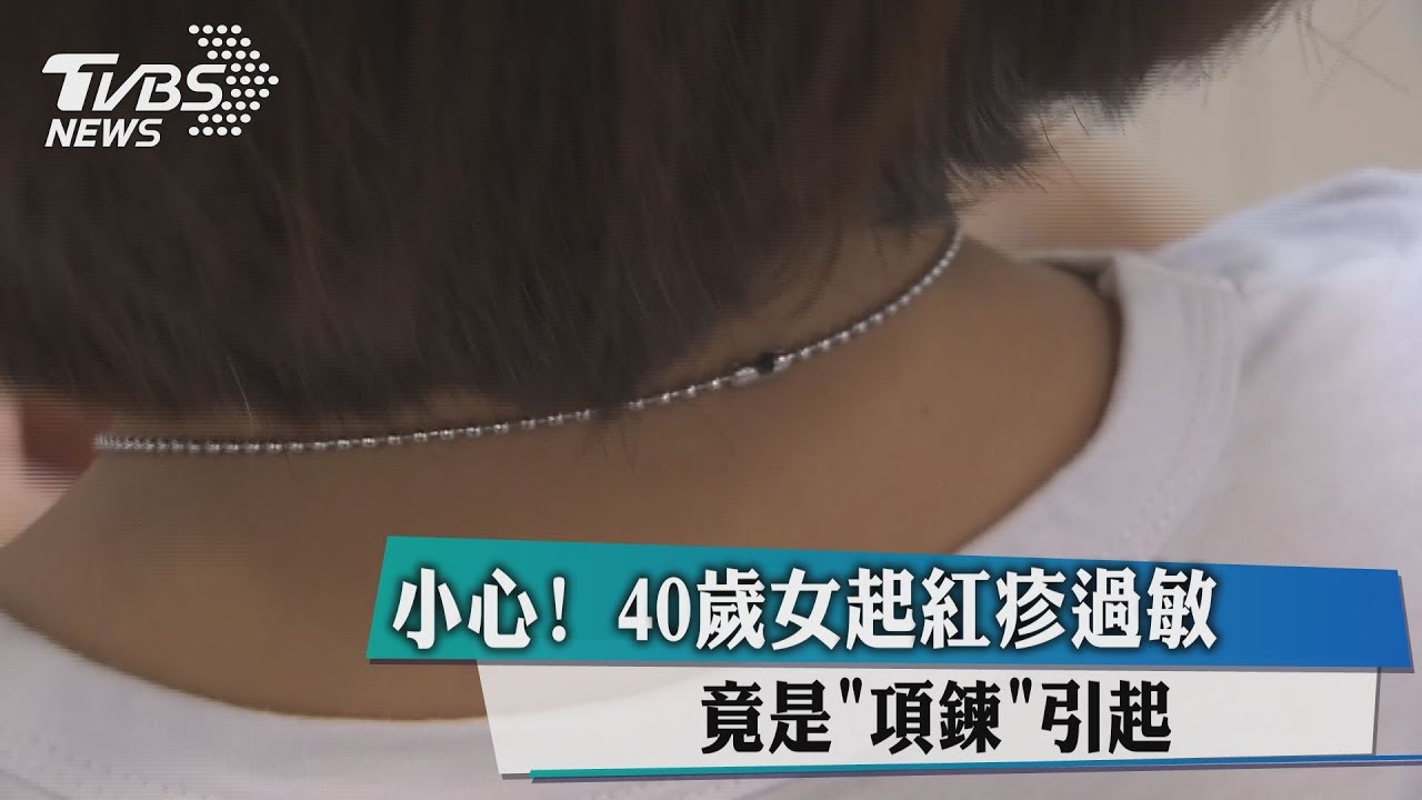 小心!43歲女起紅疹過敏 竟是「項鍊」引起