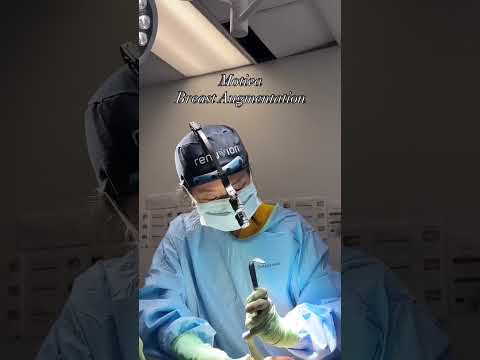 Motiva Implants- Breast Augmentation! #breastaugmentation #breastimplants