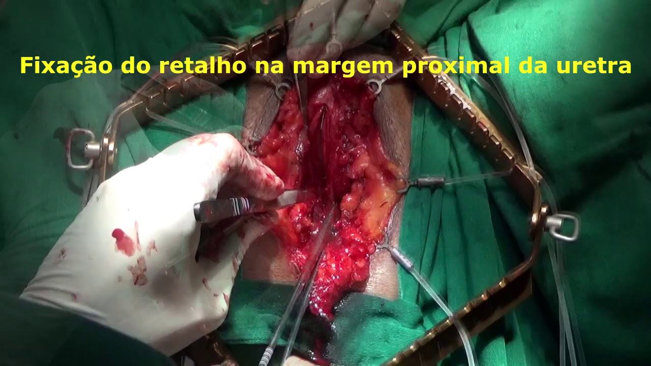 Luis Otávio Pinto-9