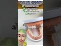 Moldable false teeth ✅ #tipsandhacks