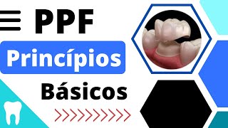 PRINCÍPIOS BÁSICOS para a CONFECÇÃO da PRÓTESE FIXA
