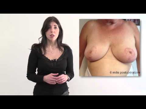 comment rembourser son soutien-gorge