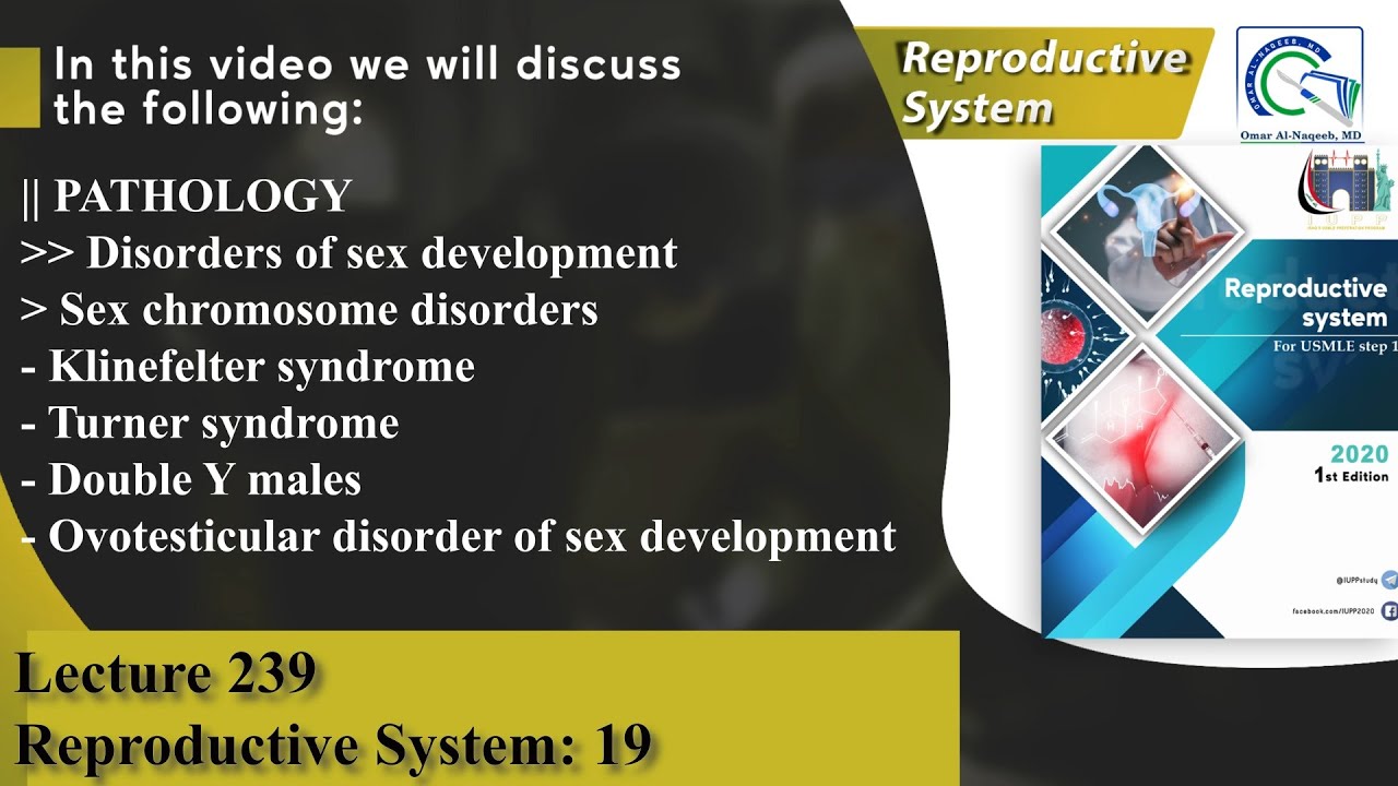 Klinefelter syndrome | Turner syndrome | Double Y males | Ovotesticular disorder of sex development