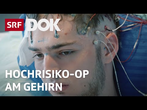 Leben ohne Epilepsie | Hochriskante Hirn-OP soll Anfälle verhindern | Doku | SRF Dok