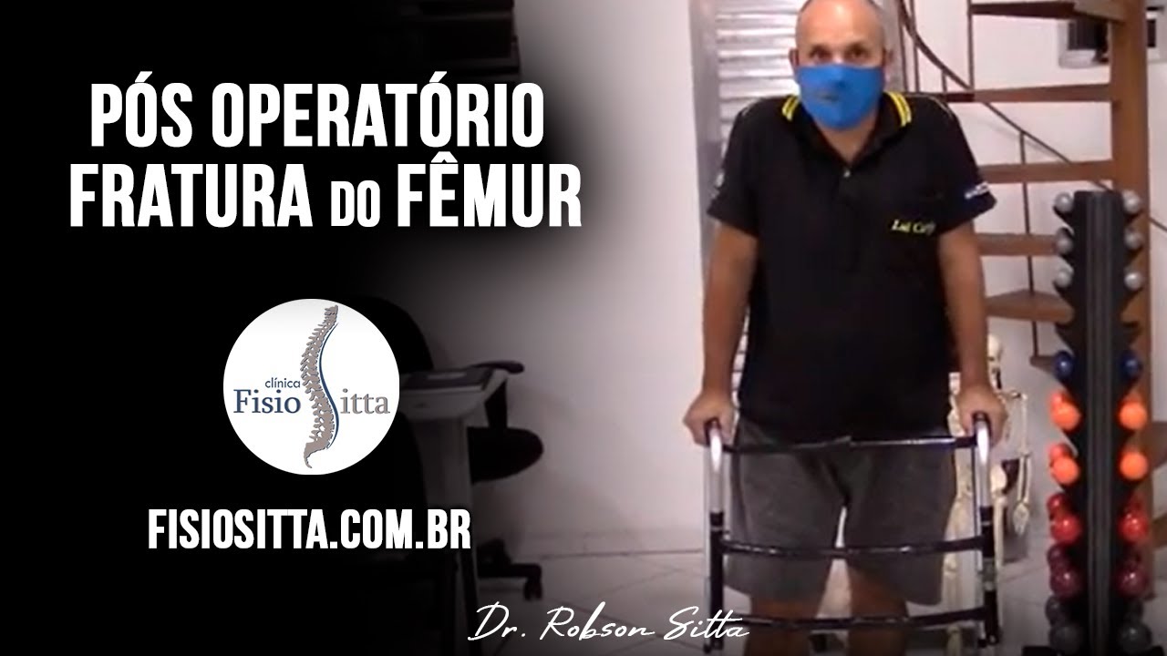 FRATURA do FÊMUR TRATAMENTO de FISIOTERAPIA PÓS OPERATÓRIO TARDIO Fisioterapia Dr. Robson Sitta