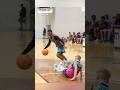 He BROKE His Ankles 4 TIMES In ONE Game
