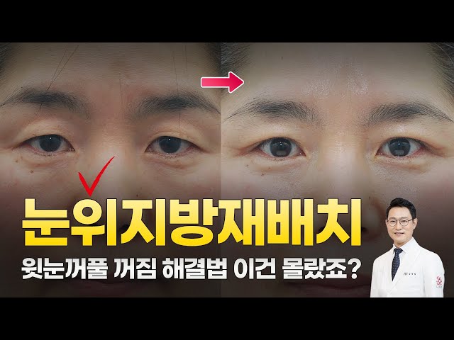라리성형외과 라리성형외과
