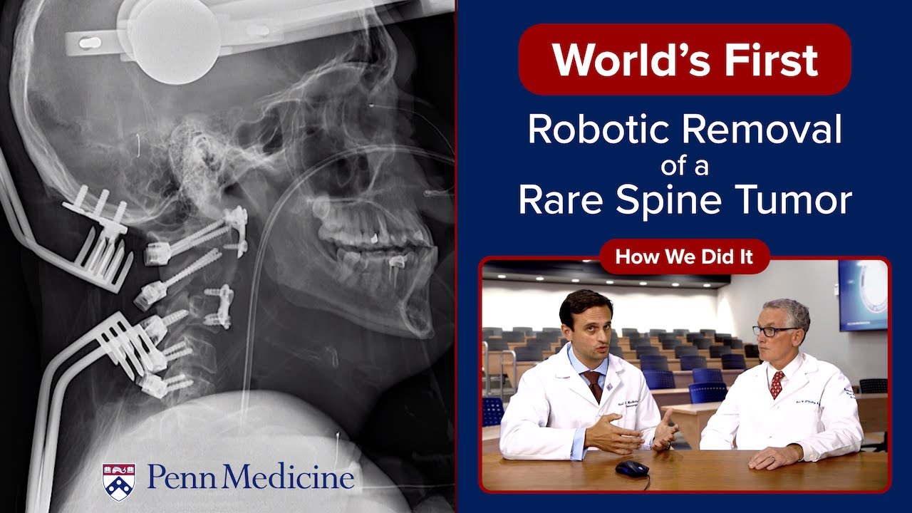 Watch video titled World’s First En Bloc Resection of Rare Chordoma Tumor: How We Did It on YouTube