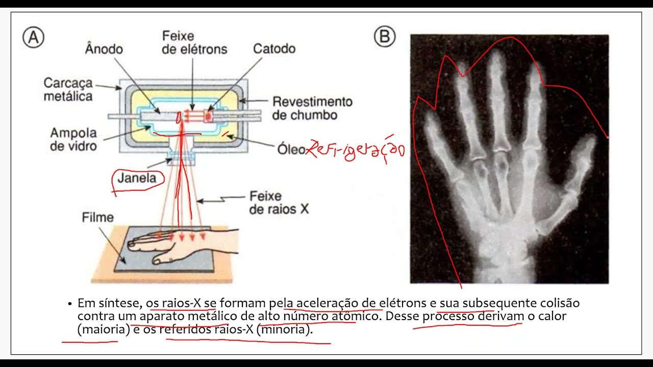 Aparelho de Raios-X Odontológico