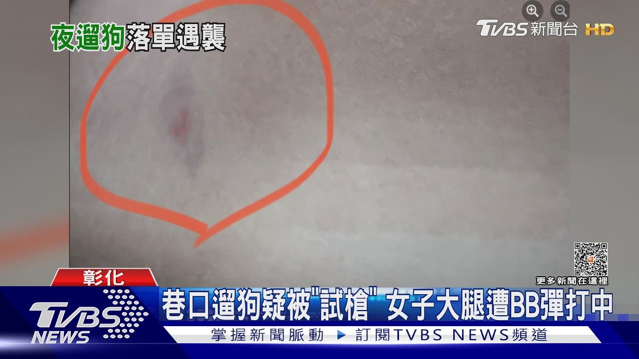 巷口遛狗疑被「試槍」 女子大腿遭BB彈打中