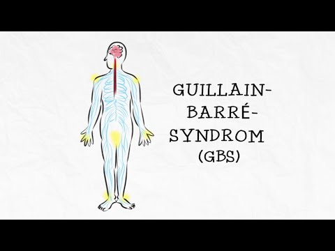 Das Guillain-Barré-Syndrom (GBS)