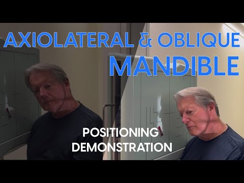Axiolateral and Axiolateral Oblique Mandible Radiographic Positioning Demonstration