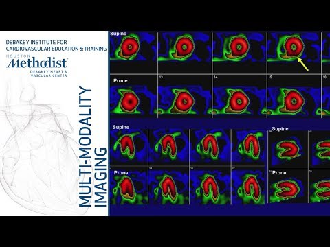 Nuclear Cardiology: Understanding the Basics (John J. Mahmarian, MD) October 16, 2018