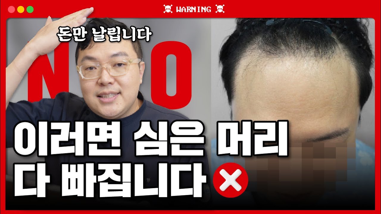 삽입 후 빠지지 않도록! 모발이식 수술 후 관리방법