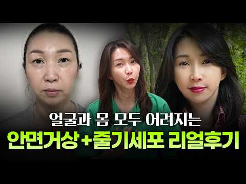 50대피부재생시술, 속당김·모공 고민에 자가지방줄기세포시술 후기ㅣ디에이성형외과ㅣ속당김피부개선