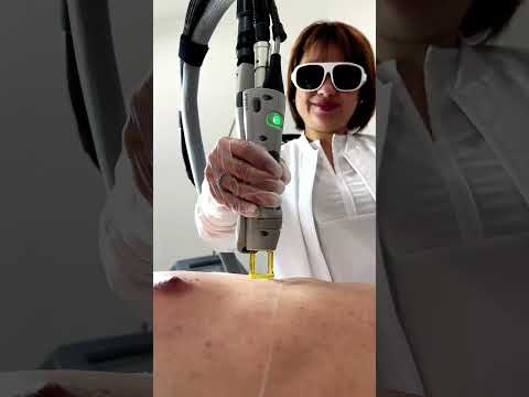 Laser Hair Removal Only Good for Women? 🤔 Absolutely...