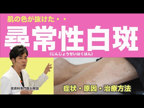 白斑について詳しく解説