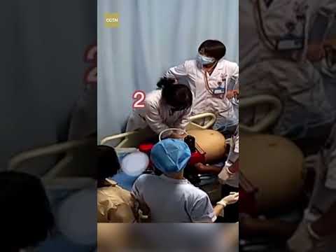 6 doctors save heart attack victim with extended CPR