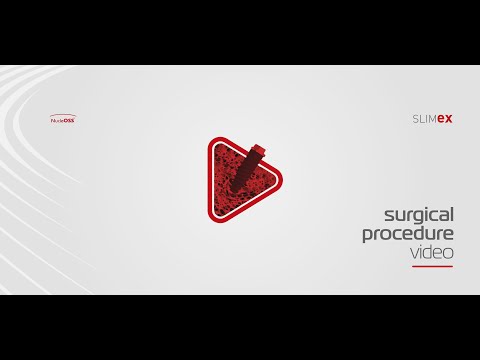 New SLIMEX - Surgical Procedure Video