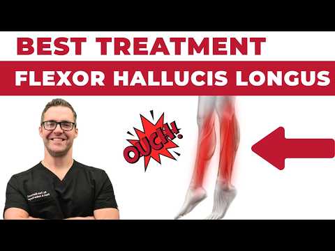 BEST 25 Plantar Fasciitis HOME Treatments Massage Stretches Shoes