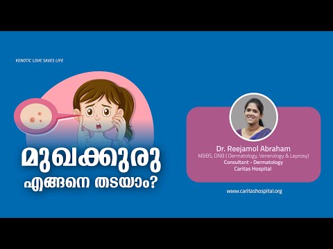 How to prevent acne?