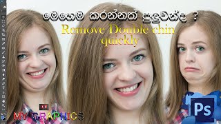 Remove double chin quickly