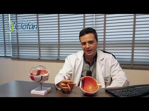 Dr Juan -Síntomas del Glaucoma