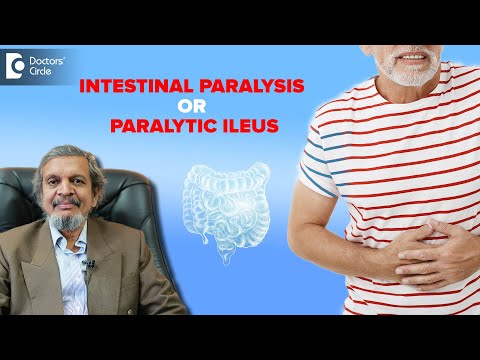 Intestinal Paralysis| Paralytic Ileus - Symptoms & Treatments - Dr. Rajasekhar M R| Doctors' Circle