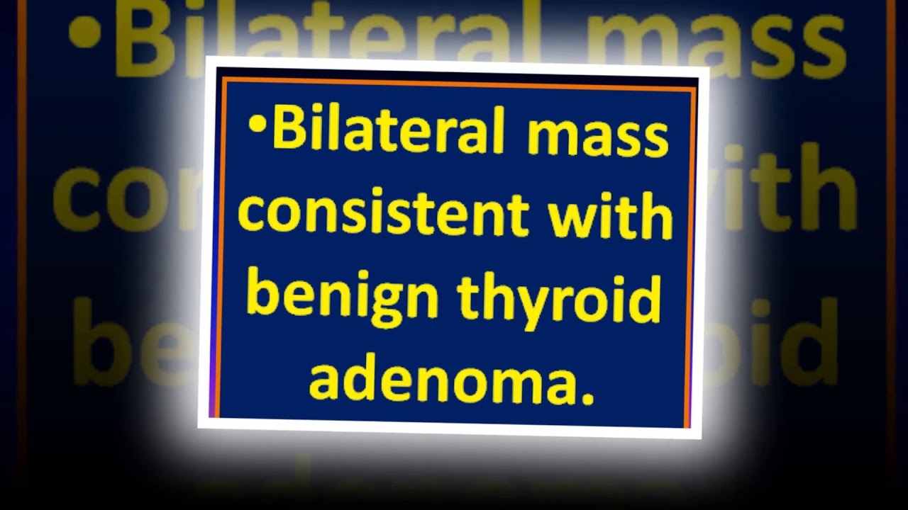 Ultrasound cases 445 of 2000 || Benign thyroid adenoma - YouTube