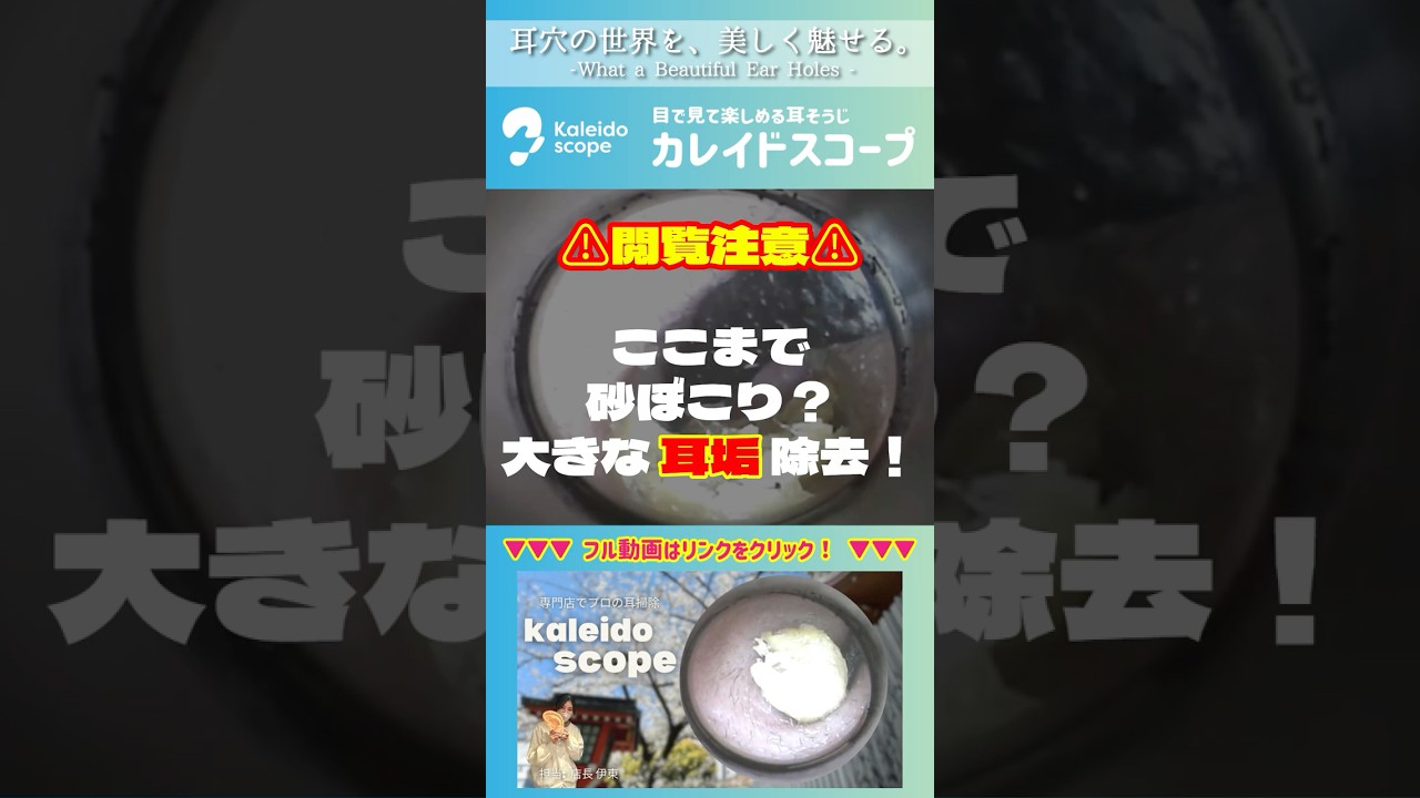【閲覧注意】ここまで砂ぼこり？大きな耳垢除去！
