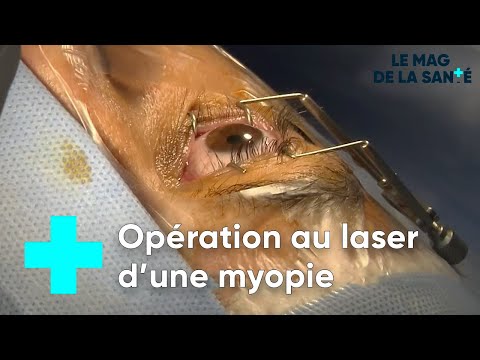 Correcting myopia with laser surgery - The Health Magazine