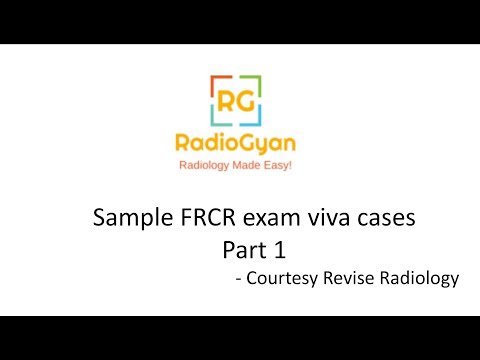 FRCR part 2B viva cases |  RadioGyan.com - Radiology Made Easy