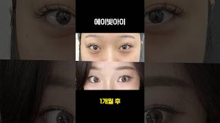 에이빛아이로 다크서클 순삭 ✔️